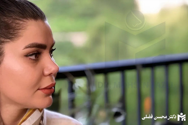 تغییرات قوس بینی پس از جراحی راهنمای کامل و جامع مراقبتی